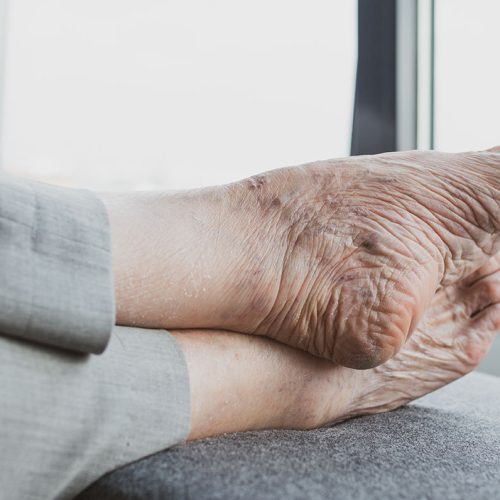 elderly ladies feet